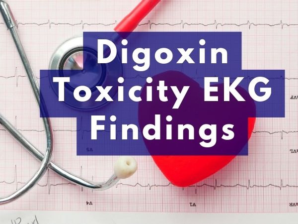 Digoxin Toxicity EKG Findings for Early Treatment: A Practical Guide in ...